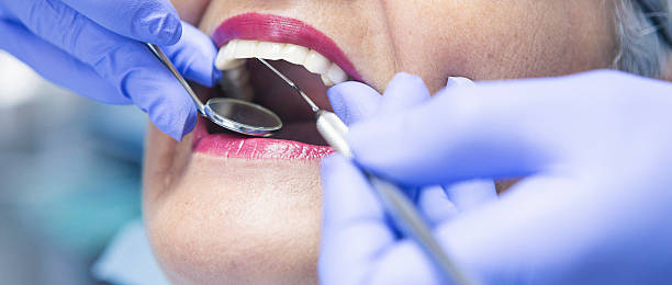 Best Knocked-Out Tooth (Avulsed Tooth) Treatment in Waymart, PA